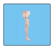 Conventional Trans-tibial Prosthesis