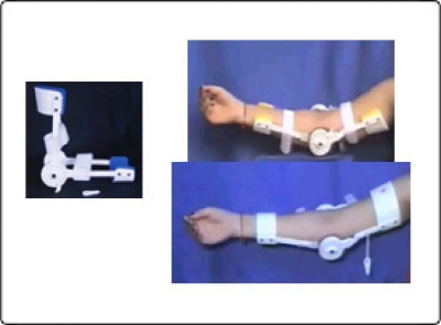 Dynamic Elbow Flexion Extension Orthosis