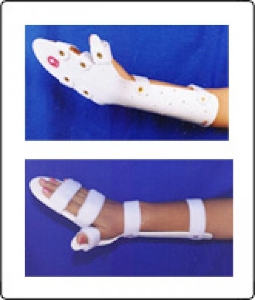 Half Cock-up Splint