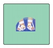 Orthotic Device: CTV Splints