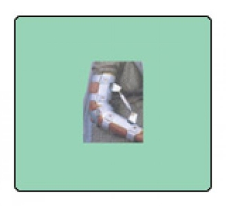 Orthotic Device: Elbow Orthosis