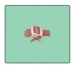 Orthotic Device: Knuckle bender