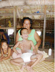 Young boy with hydrocephalus